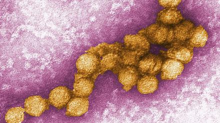Das West-Nil-Virus unter dem Elektronenmikroskop. 