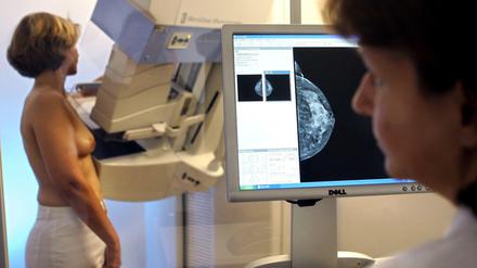 Vorsorge. Bei einer Mammografie kann Brustkrebs frühzeitig entdeckt werden - umso schonender kann dann eine Therapie sein.