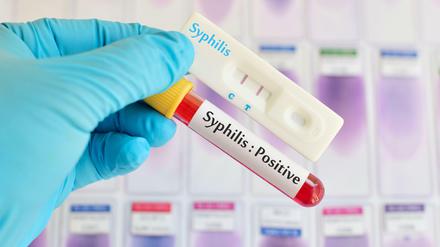 Jährlich infizieren sich in Deutschland etwa 8000 Menschen mit Syphilis - dabei hatte man geglaubt, die Krankheit sei ausgerottet.