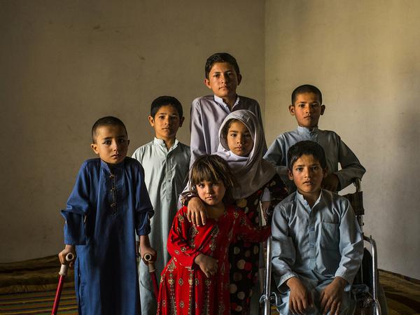 Das zweitplatzierte Foto ist von Andrew Quilty. Es zeigt sieben afghanische Kinder aus einem abgelegenen Dorf im Distrikt Surkh Rod, die bei der Explosion eines Blindgängers schwer verletzt worden sind. 