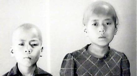 Strahlenopfer der Bombe. Kinder aus Nagasaki.
