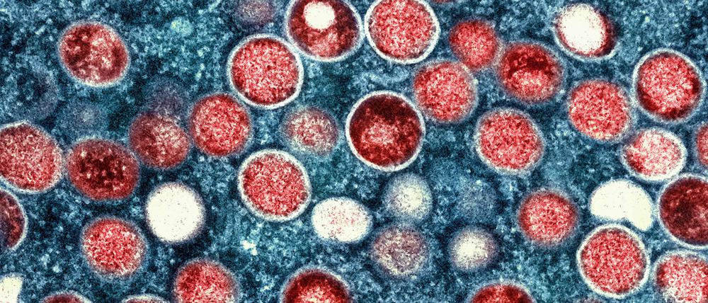 Eine kolorierte mikroskopische Aufnahme von Partikeln des Affenpockenvirus in einer infizierten Zelle 