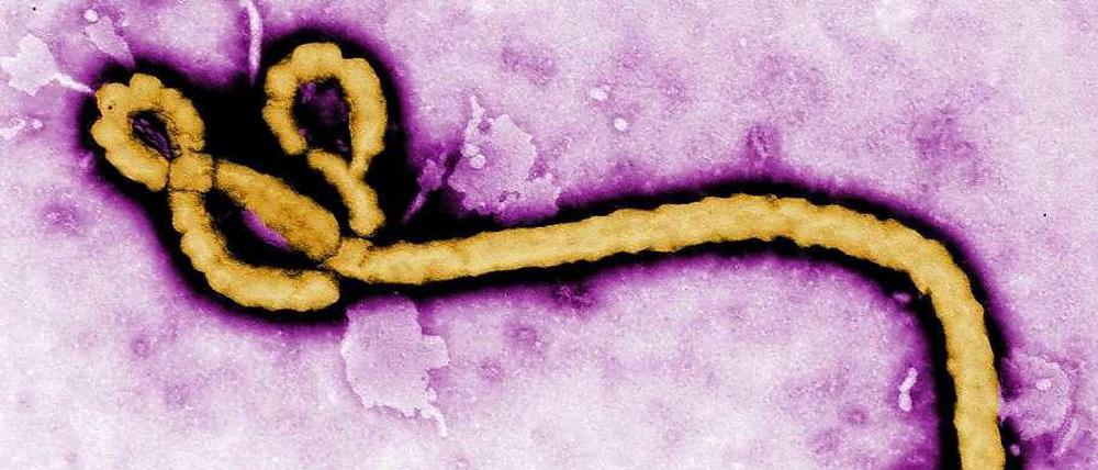 Ebola-Virus.