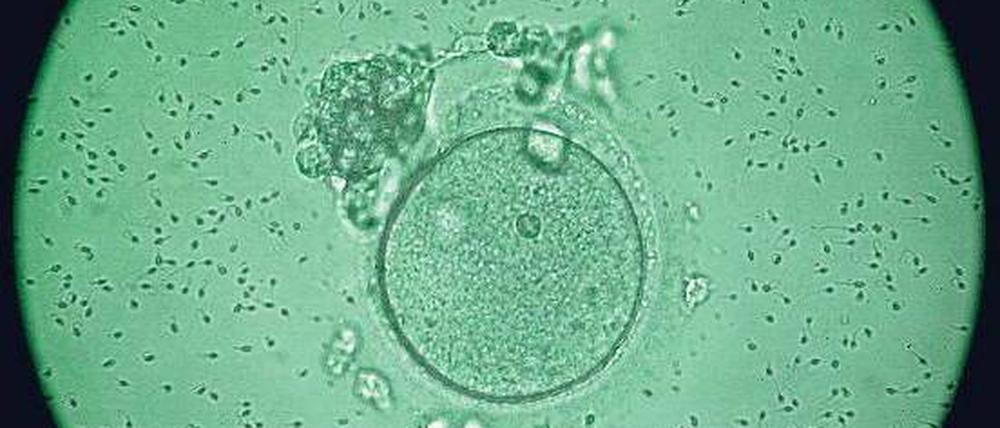 Künstliche Befruchtung mit großen Folgen. Die Mikroskopaufnahme zeigt eine Eizelle, die von Samenzellen umgeben ist. Foto: dpa