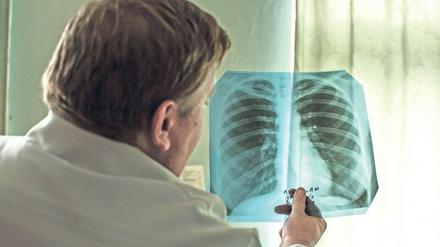 Ein Arzt betrachtet in einem ukrainischen Tuberkulose-Behandlungszentrum die Röntgenaufnahme einer Lunge.