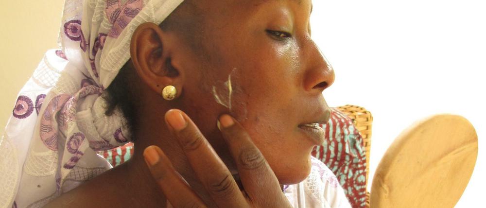 Bintou Dembele, 33, arbeiten in der Textilindustrie in Malis Haupstadt Bamako. Mit einer Creme möchte sie ihre Haut bleichen. Die Weltgesundheitsorganisation warnt vor den Cremes. 