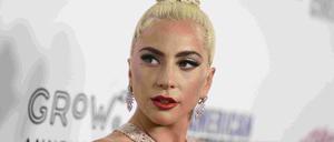 Lady Gaga, amerikanischer Pop-Star, hat Angst um ihre Bulldogen.