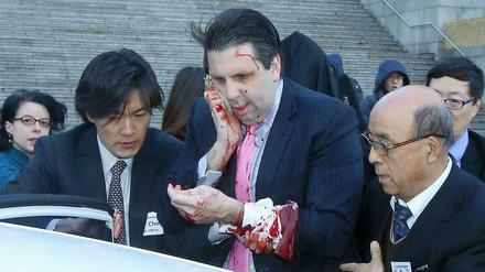 US-Botschafter Mark Lippert nach der Messerattacke in Südkorea. 