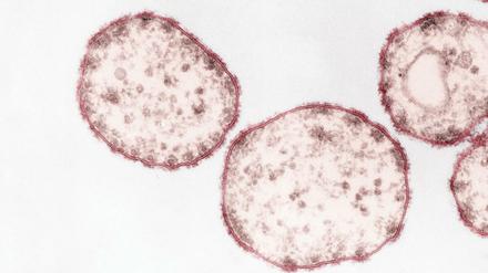 Das Masernvirus (Paramyxoviren) im Ultradünnschnitt. 