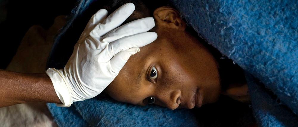 Eine HIV-positive Patientin in einer Krankenstation in Ha Ramajoro/Lesotho mit ihrem antiretroviralen Medikament. Die Vereinten Nationen melden Fortschritte bei der Behandlung von HIV-positiven Menschen.