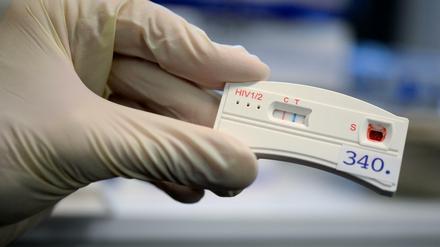 HIV-Tests gab es bisher nur in Arzt-Praxen.