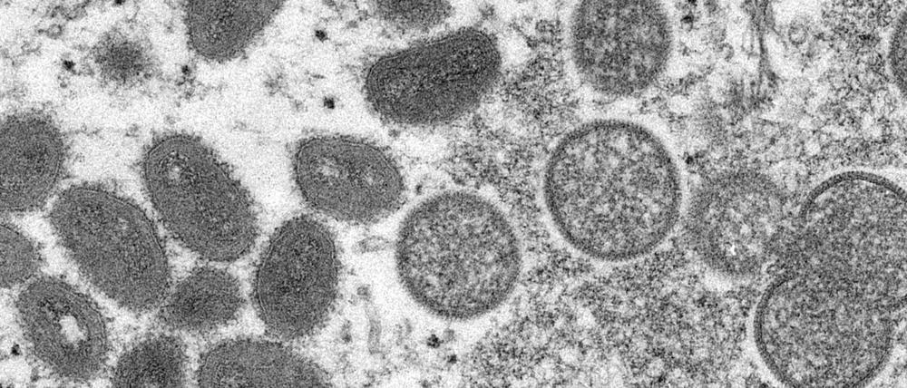 Elektronenmikroskopische Aufnahme des Centers for Disease Control and Prevention zeigt reife, ovale Affenpockenviren (l) und kugelförmige unreife Virionen (r).