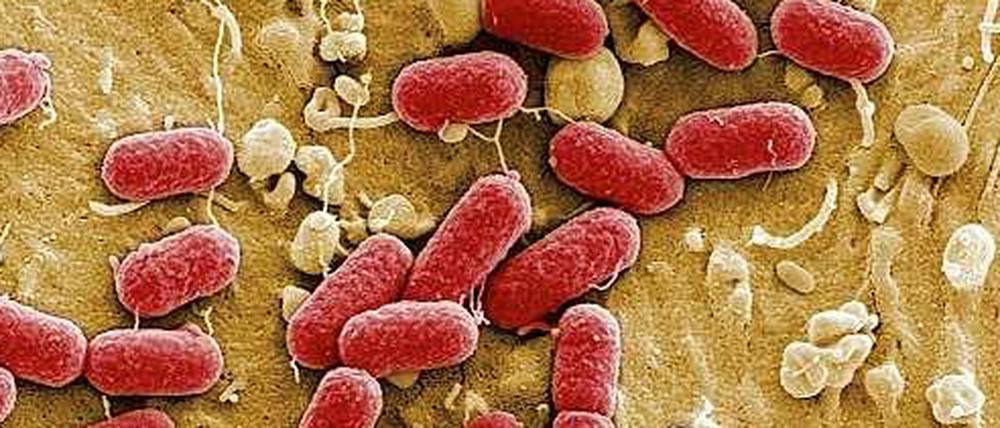 EHEC-Bakterien,eine gefährlichen Variante des harmlosen Darmbewohners Escherichia coli, unter dem Elektronenmikroskop.