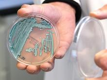 „Untypisch und sehr besorgniserregend“: Zahl der Pilzinfektionen mit Candida auris steigt deutlich