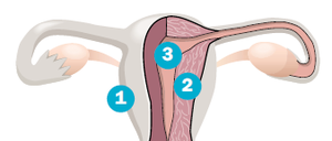 Die Gebärmutter (Uterus) (1) ist ein birnenförmiges, rund sieben bis neun Zentimeter langes und fünf Zentimeter breites Hohlorgan. Der Gebärmutterkörper (2) besteht aus muskulösem Gewebe, das innen - in der Gebärmutterhöhle (3) - mit einer Schleimhaut ausgekleidet ist. In diese nistet sich eine befruchtete Eizelle ein..