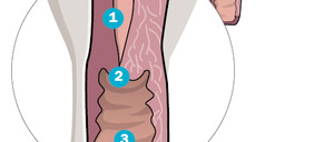 Der Gebärmutterhals (1) ist der untere Teil der Gebärmutter. Er mündet in den Muttermund (2), der die Gebärmutter nach unten hin zur Scheide (3) abschließt.