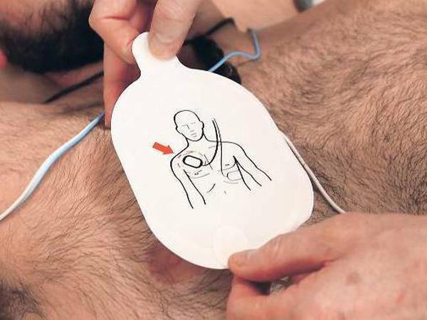 Im Notfall stellt ein Defibrillator mit Stromstößen den Herzschlag wieder her.