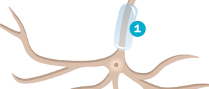 Multiple Sklerose betrifft das zentrale Nervensystem. An den Markscheiden (1), die die Schutzschicht der Nervenfasern in Gehirn und Rückenmark bilden, entstehen Entzündungen. Diese führen dazu, dass die Befehle des Gehirns nur noch eingeschränkt zu den Muskelzellen des Körpers weitergeleitet werden.