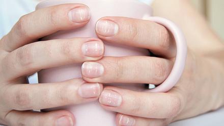 In den meisten Fällen werden weiße Flecken auf den Fingernägeln durch Lufteinschlüsse verursacht. 