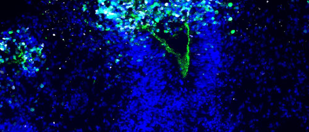 Das zerstörerische Herpes-Virus breitet sich im Organoid aus.