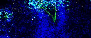 Das zerstörerische Herpes-Virus breitet sich im Organoid aus.