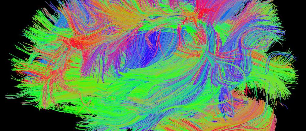 Im Gehirn lassen mit zunehmendem Alter die Verknüpfungen der Nervenzellen, die Synapsen, und damit das Gedächtnis nach. Das Protein „Klotho“ kann das reparieren. 