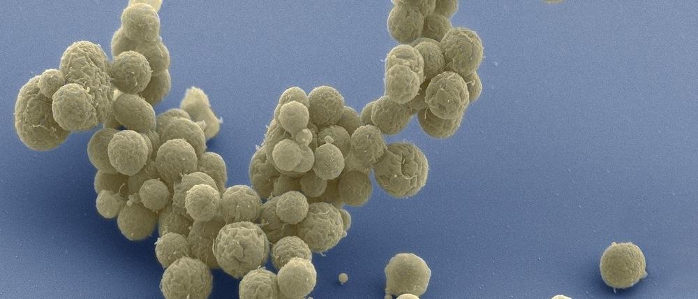 Eine um 15.000-mal vergrößerte Aufnahme des Bakteriums Mycoplasma mycoides.