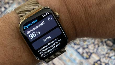 Eine Apple Watch 6 am Handgelenk eines Mannes.