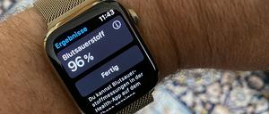 Eine Apple Watch 6 am Handgelenk eines Mannes.
