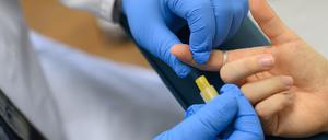 Die Aids-Hilfe Sachsen-Anhalt, demonstriert im Labor die Blutentnahme für einen HIV-Test.