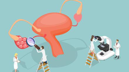 Wissenschaftlerinnen untersuchen einen Eierstock mit Ausstülpungen (Illustration).