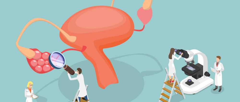 Wissenschaftlerinnen untersuchen einen Eierstock mit Ausstülpungen (Illustration).