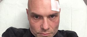 Thorsten S. wurde in der Nacht zu Sonnabend in Berlin-Schöneberg am Nollendorfplatz attackiert. 