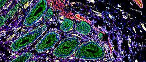 Über 500 verschiedene Zelltypen konnten die Forschenden durch die hochauflösende Kartierung des Darms identifizieren.
