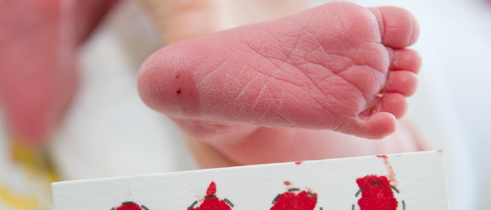 Studien an Kindern stellen Ärzt:innen immer wieder vor Probleme. Bei einem Präparat für Mukoviszidose griff die Charité nun zu einer Alternativmethode. Im Bild ein Test auf die Krankheit.