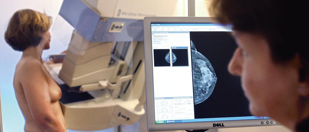 Das Bild einer Mammografie ist in Münster auf einem Computermonitor zu sehen, während eine weitere Aufnahme mit dem Volldigitalen Scanverfahren vorbereitet wird.