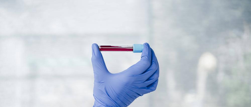 Das Geschäft mit Bluttests wächst. Das zieht auch Start-ups an.