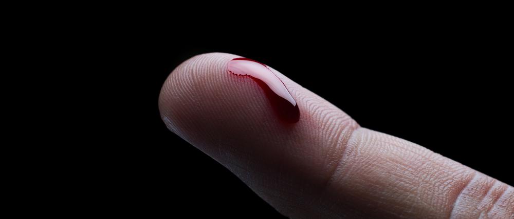 Biomarker kann man sich wie biologische Informanten im Blut vorstellen.