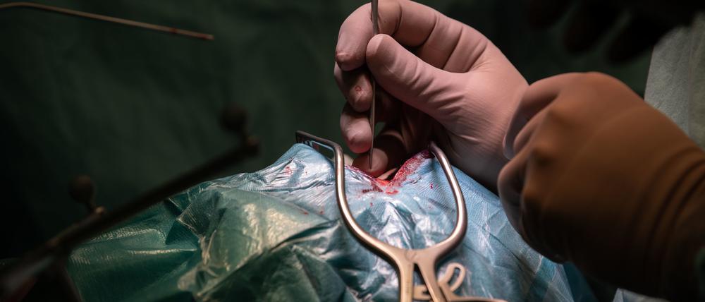 Vor allem bei chirurgischen Eingriffen vermuteten Patienten oft Behandlungsfehler.