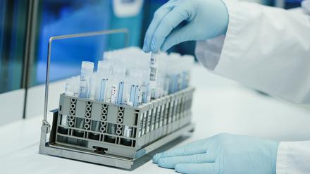 PCR-Teströhrchen in einem Labor.