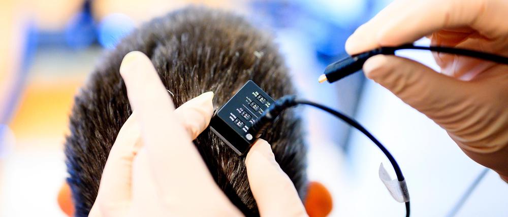 UCSF clinical research coordinator Max Dougherty connects a neural data port in the study participant’s head to the speech prosthesis system on Monday, May 22, 2023, in El Cerrito, Calif as part of Dr. Edward Chang’s study of speech neuroprostheses.