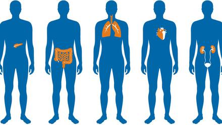 Kann jedem an die Nieren gehen. Die Debatte um die Organspende.