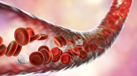 Personen mit Hämophilie fehlen spezielle Eiweiße im Blut, Wunden verschließen sich daher nicht richtig.