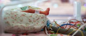 Versorgung eines Fünflings im Brutkasten