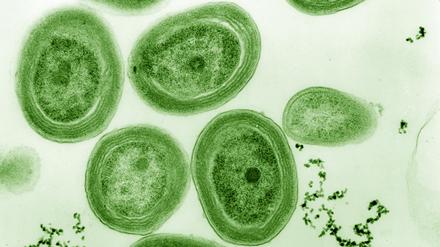 Prochlorococcus ist eine Blaualge, ein Cyanobakterium, schimmert aber dennoch grünlich. 