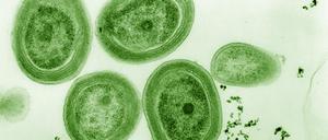 Prochlorococcus ist eine Blaualge, ein Cyanobakterium, schimmert aber dennoch grünlich. 