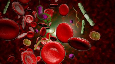 Sepsis ist die häufigste Todesursache bei Infektionen.