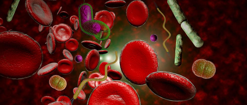 Sepsis ist die häufigste Todesursache bei Infektionen.