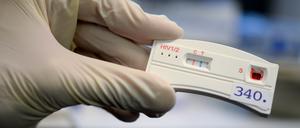 Der Teststreifen an einem HIV-Schnelltest verfärbt sich bei der Berliner Aids-Hilfe e.v. nach der Anwendung mit dem Blut eines Mannes.