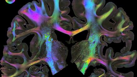 FiberOrientationMap HumanBrain